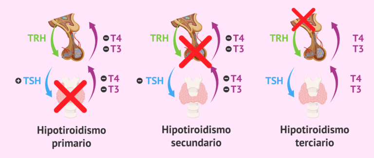 prueba rápida de tsh